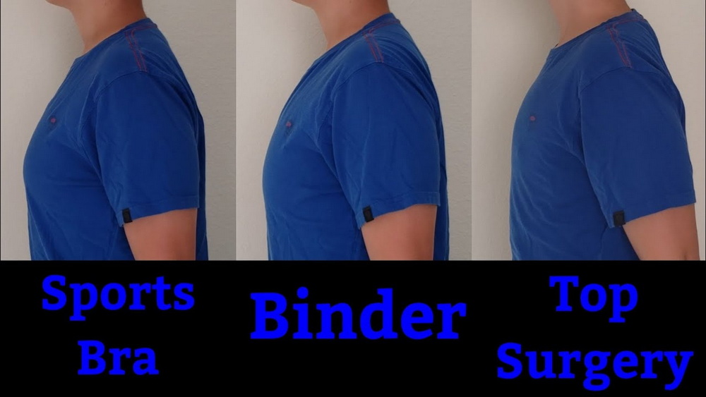 sports bra vs binder vs top surgery