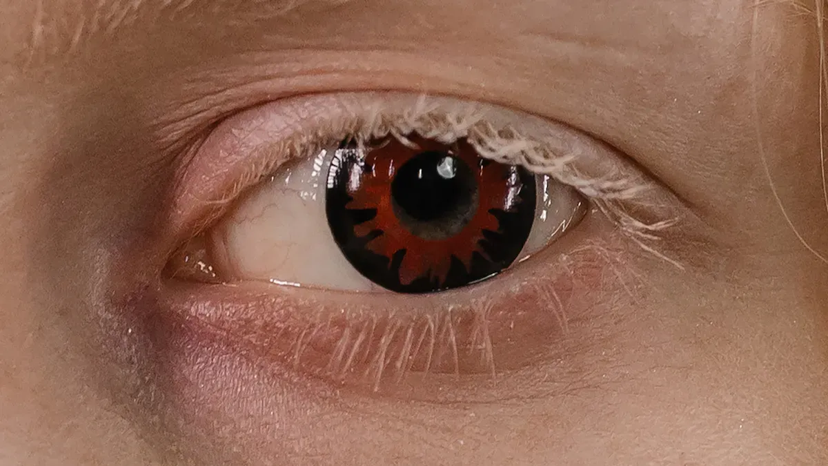 Communis Contactus Lens Solatium Exitus