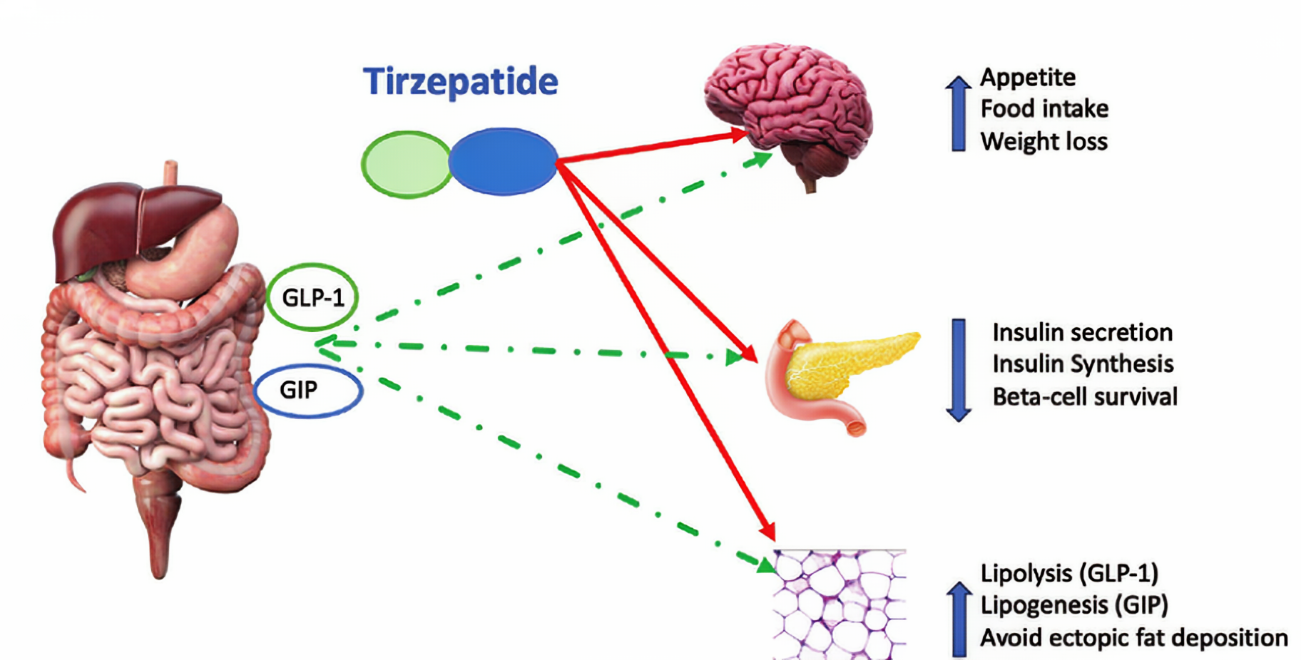 tirzepatide for weight loss tirzepatied vir gewigsverlies