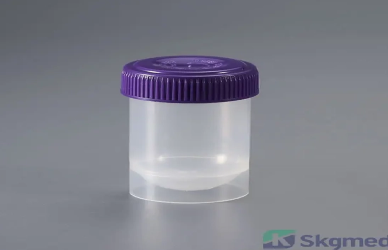 hộp đựng nước tiểu