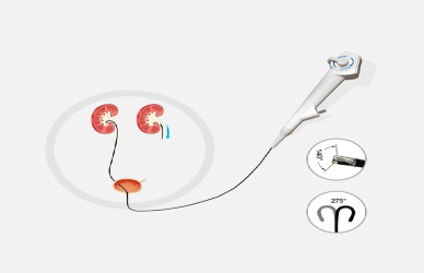 Flexible Ureteroscopes Ureteroscopi flessibili